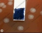 Neisseria meningitidis oxidase test
